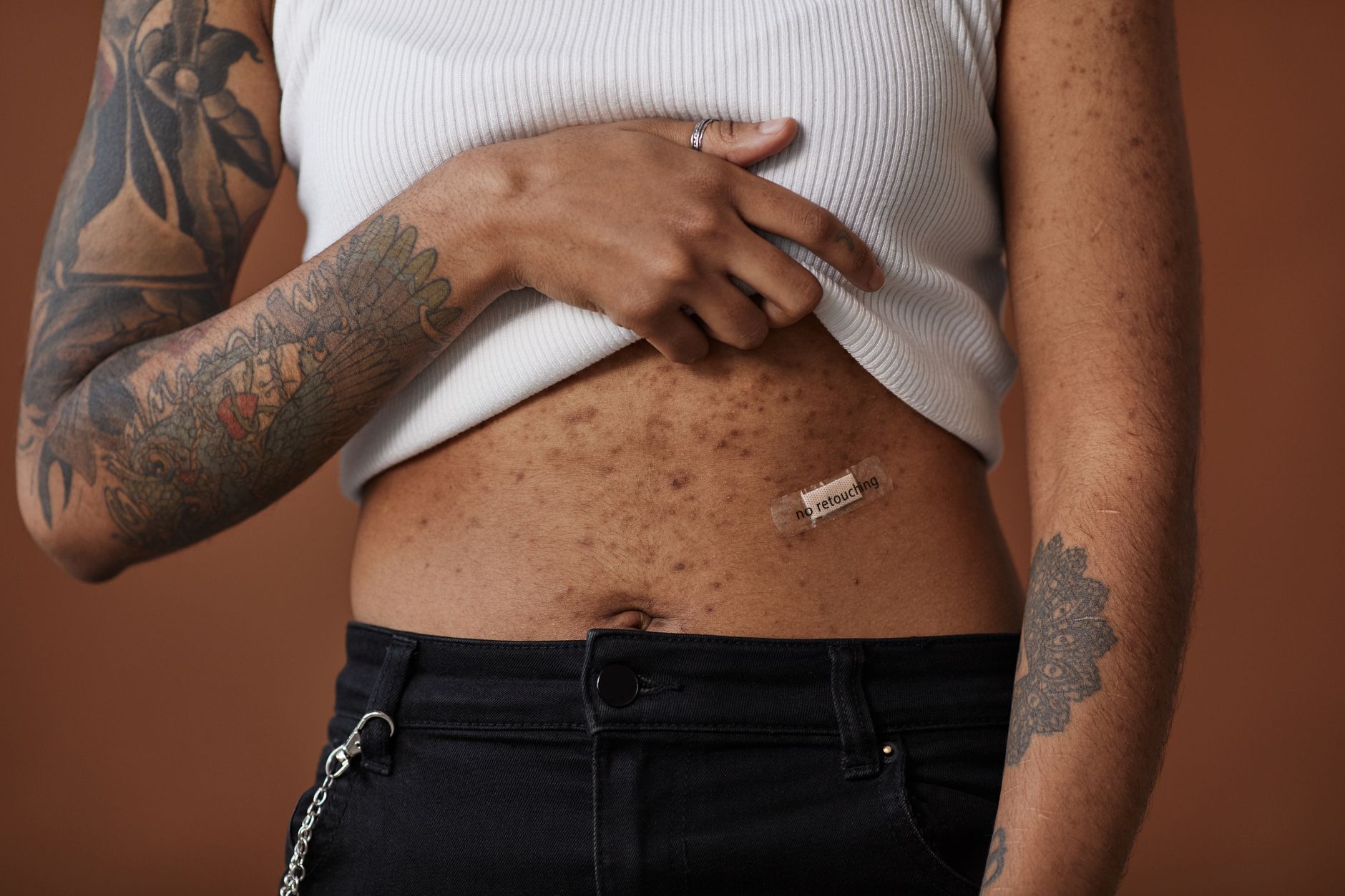 Why Luxury Brands Suddenly Care About Body Acne: From Ignored to Serumified in One Quarter